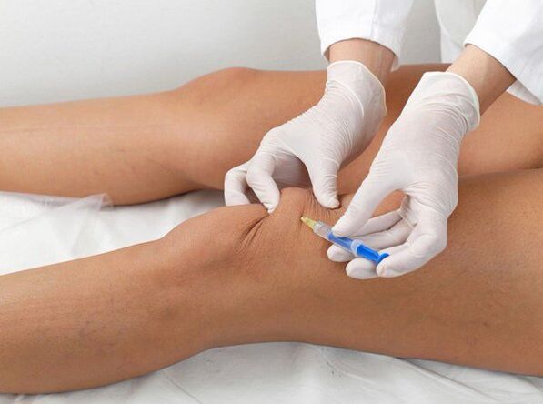 Inxección intraarticular para artrose de xeonllo